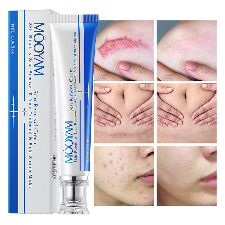 Scar Removal Repairing Cream Moisturizing Skin Recovery Wound Care Scar Correcting Corrector for Skin Therapy Scar Removal Repairing Cream Moisturizing Skin Recovery Wound Care Scar Correcting Corrector for Skin Therapy