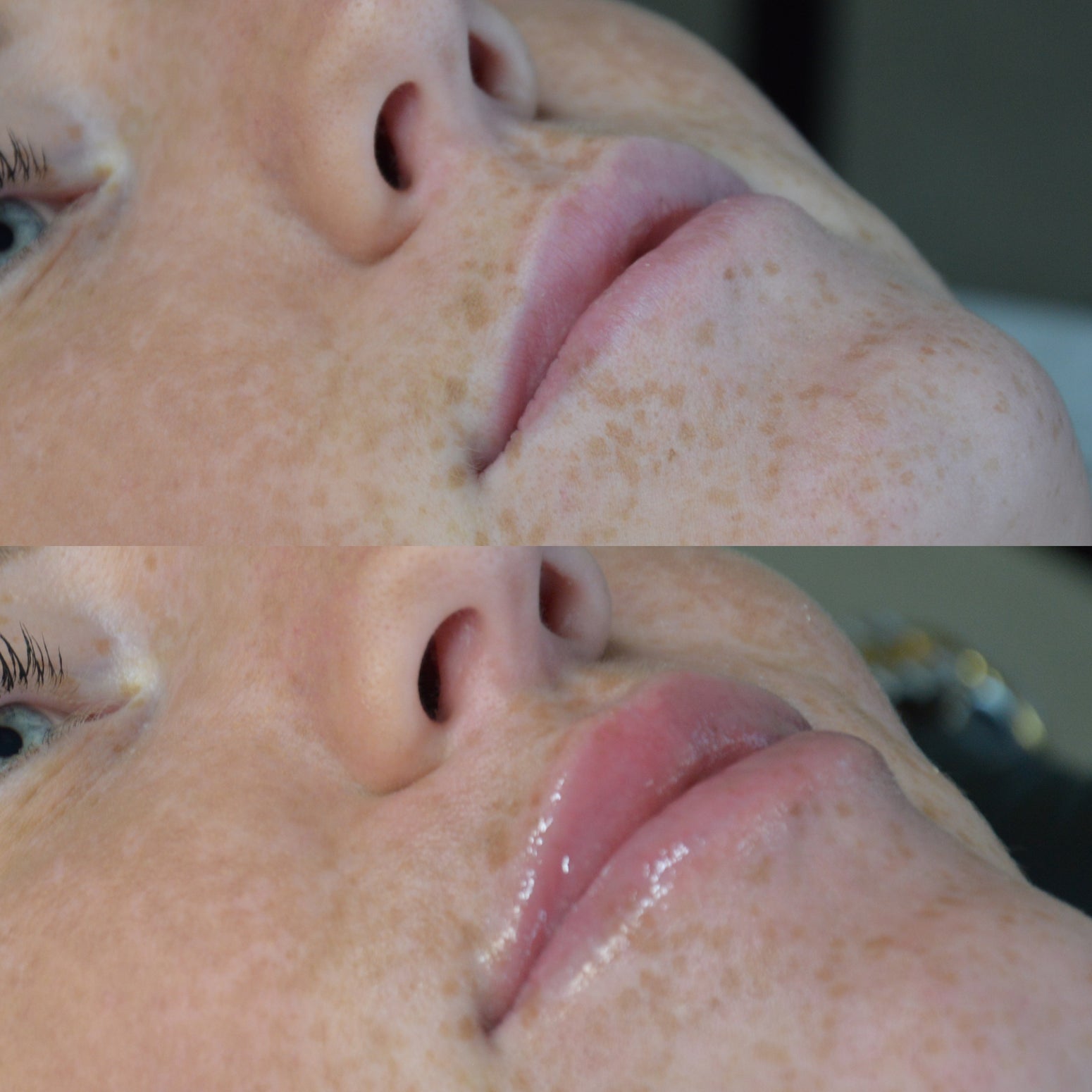 Collageen Lip Therapie Cursus en BB Lips Collageen Lip Therapie Cursus en BB Lips
