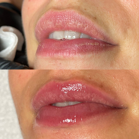 3x Meer Volume met de Collageen Lip Therapie Cursus