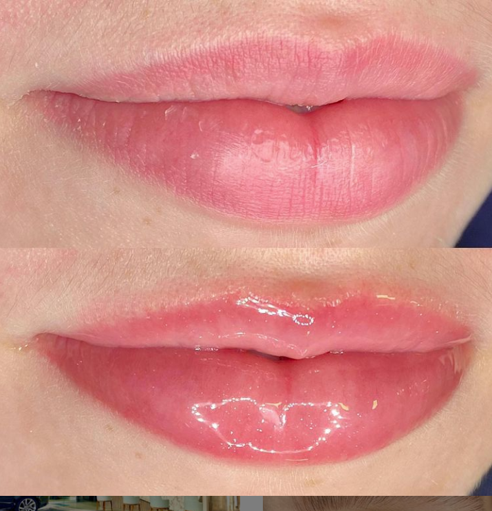 Collageen Lip Therapie Cursus en BB Lips